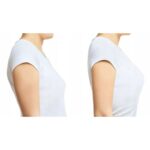 SENSIPLAST Shoulder Support S- M - Image 3